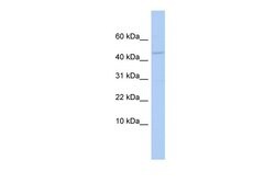 Invitrogen APOBEC3F Polyclonal Antibody 100 μL; Unconjugated:Antibodies,
