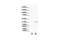 ATP6V0D2 Polyclonal Antibody:Antibodies, Polyclonal