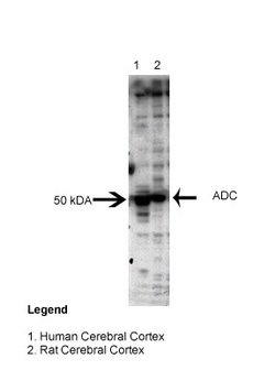 Invitrogen ADC Polyclonal Antibody 100 &mu;L; Unconjugated:Antibodies,