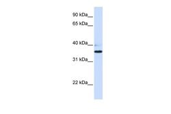 B3GALT1 Polyclonal Antibody:Antibodies, Polyclonal