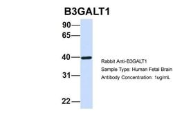 B3GALT1 Polyclonal Antibody:Antibodies, Polyclonal
