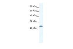 CACNG6 (extracellular) Polyclonal Antibody