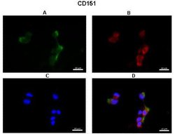 Invitrogen CD151 Polyclonal Antibody 100 &mu;L; Unconjugated:Antibodies,