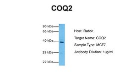 Invitrogen COQ2 Polyclonal Antibody 100 &mu;L; Unconjugated:Antibodies,