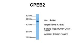 Invitrogen CPEB2 Polyclonal Antibody 100 &mu;L; Unconjugated:Antibodies,