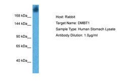 Invitrogen GP340 Polyclonal Antibody 100 &mu;L; Unconjugated:Antibodies,