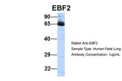 Invitrogen EBF2 Polyclonal Antibody 100 μL; Unconjugated:Antibodies,