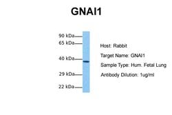 Invitrogen GNAI1 Polyclonal Antibody 100 &mu;L; Unconjugated:Antibodies,