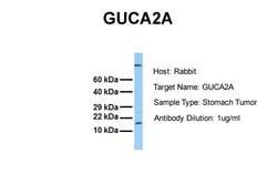 Invitrogen GUCA2A Polyclonal Antibody 100 &mu;L; Unconjugated:Antibodies,