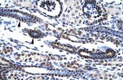 Invitrogen HES7 Polyclonal Antibody 100 &mu;L; Unconjugated:Antibodies,