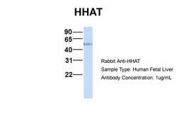 HHAT Polyclonal Antibody:Antibodies, Polyclonal