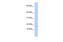 Invitrogen ISCA2 Polyclonal Antibody 100 &mu;L; Unconjugated:Antibodies,