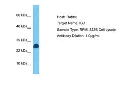 J Chain Polyclonal Antibody:Antibodies, Polyclonal