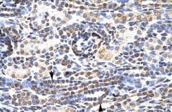 Invitrogen KLF9 Polyclonal Antibody 100 μL; Unconjugated:Antibodies,