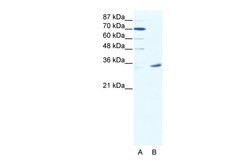 Invitrogen MAGEA9 Polyclonal Antibody 100 &mu;L; Unconjugated:Antibodies,
