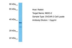 Invitrogen Nkx3.2 Polyclonal Antibody 100 μL; Unconjugated:Antibodies,