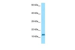 Invitrogen ORMDL3 Polyclonal Antibody 100 &mu;L; Unconjugated:Antibodies,