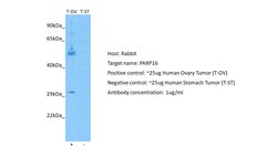 Invitrogen PARP16 Polyclonal Antibody 100 &mu;L | Buy Online | Invitrogen&trade; | Fisher Scientific