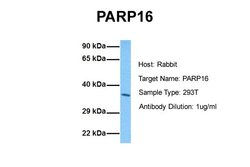 Invitrogen PARP16 Polyclonal Antibody 100 &mu;L | Buy Online | Invitrogen&trade; | Fisher Scientific