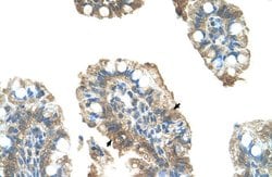 Invitrogen PARP6 Polyclonal Antibody 100 &mu;L; Unconjugated:Antibodies,