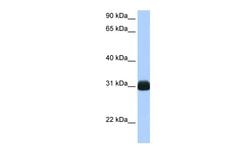 Invitrogen RBPMS Polyclonal Antibody 100 μL; Unconjugated:Antibodies,