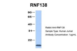 RNF138 Polyclonal Antibody:Antibodies, Polyclonal