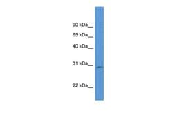 Invitrogen RPIA Polyclonal Antibody 100 &mu;L; Unconjugated:Antibodies,