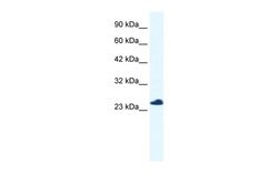 Invitrogen RTRAF Polyclonal Antibody 100 &mu;L; Unconjugated:Antibodies,