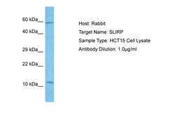 Invitrogen SLIRP Polyclonal Antibody 100 &mu;L; Unconjugated:Antibodies,