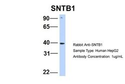 Invitrogen SNTB1 Polyclonal Antibody 100 μL; Unconjugated:Antibodies,