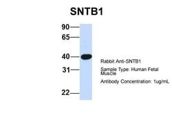 Invitrogen SNTB1 Polyclonal Antibody 100 μL; Unconjugated:Antibodies,