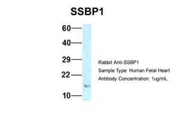 Invitrogen SSBP1 Polyclonal Antibody 100 &mu;L; Unconjugated:Antibodies,