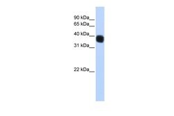 SSBP3 Polyclonal Antibody:Antibodies, Polyclonal