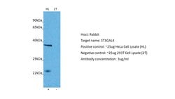 Invitrogen ST3GAL4 Polyclonal Antibody 100 &mu;L; Unconjugated:Antibodies,