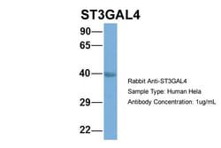 Invitrogen ST3GAL4 Polyclonal Antibody 100 &mu;L; Unconjugated:Antibodies,