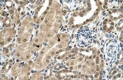 Invitrogen TBX15 Polyclonal Antibody 100 μL; Unconjugated:Antibodies,
