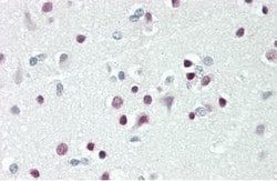 Invitrogen TBX15 Polyclonal Antibody 100 μL; Unconjugated:Antibodies,