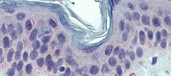 Invitrogen TYRP1 Polyclonal Antibody 100 &mu;L | Buy Online | Invitrogen&trade; | Fisher Scientific