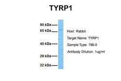 Invitrogen TYRP1 Polyclonal Antibody 100 &mu;L | Buy Online | Invitrogen&trade; | Fisher Scientific