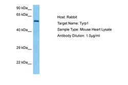 Invitrogen TYRP1 Polyclonal Antibody 100 &mu;L | Buy Online | Invitrogen&trade; | Fisher Scientific