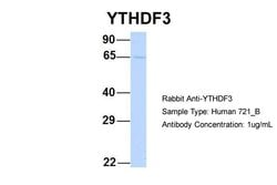Invitrogen YTHDF3 Polyclonal Antibody 100 μL; Unconjugated:Antibodies,