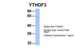 Invitrogen YTHDF3 Polyclonal Antibody 100 &mu;L; Unconjugated:Antibodies,