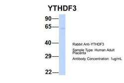 Invitrogen YTHDF3 Polyclonal Antibody 100 &mu;L; Unconjugated:Antibodies,