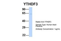 Invitrogen YTHDF3 Polyclonal Antibody 100 &mu;L; Unconjugated:Antibodies,