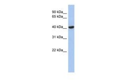 Invitrogen ZFYVE1 Polyclonal Antibody 100 &mu;L; Unconjugated:Antibodies,