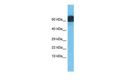 Invitrogen ZNF746 Polyclonal Antibody 100 &mu;L | Buy Online | Invitrogen&trade; | Fisher Scientific