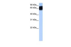 Invitrogen ZNF90 Polyclonal Antibody 100 μL; Unconjugated:Antibodies,