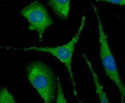 Invitrogen NOD3 Polyclonal Antibody 100 &mu;L; Unconjugated:Antibodies,