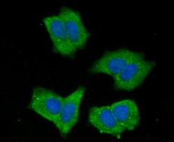 Invitrogen NOD3 Polyclonal Antibody 100 &mu;L; Unconjugated:Antibodies,