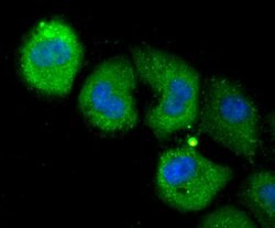 Invitrogen NOD3 Polyclonal Antibody 100 &mu;L; Unconjugated:Antibodies,